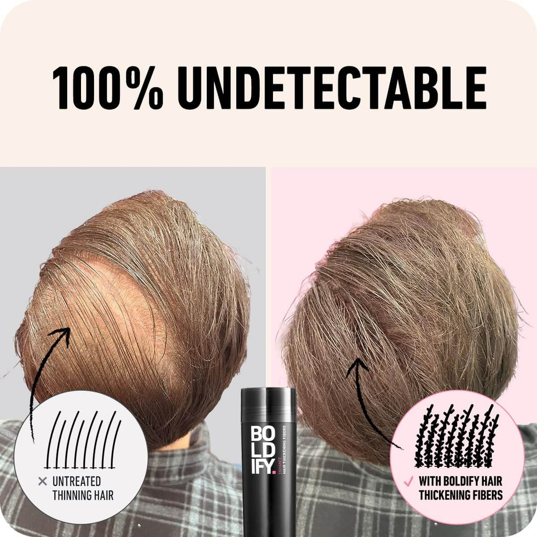 Boldify Hair Thickening Fibers 12g - 100% Undetectable