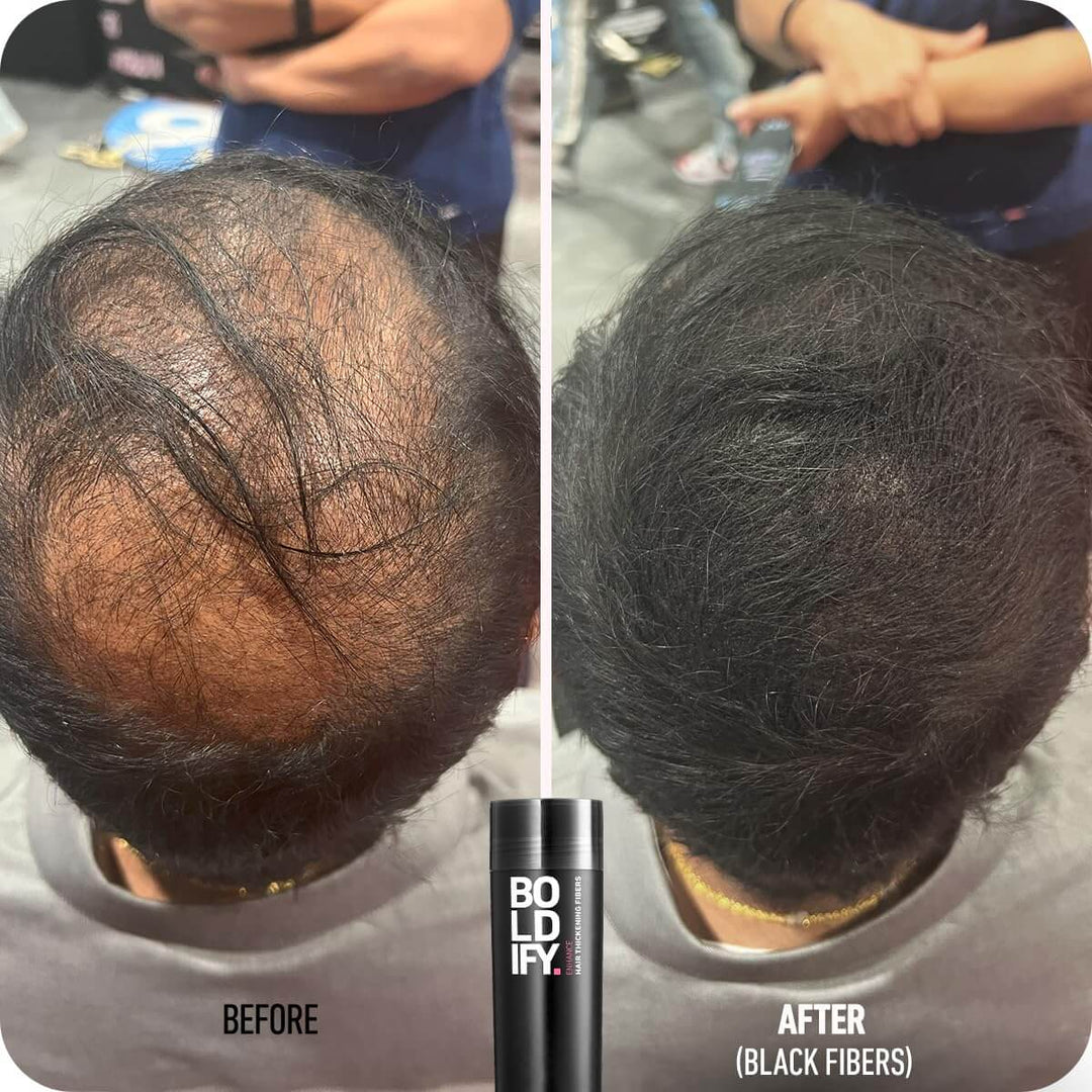 Boldify Hair Thickening Fibers 12g - Before and After