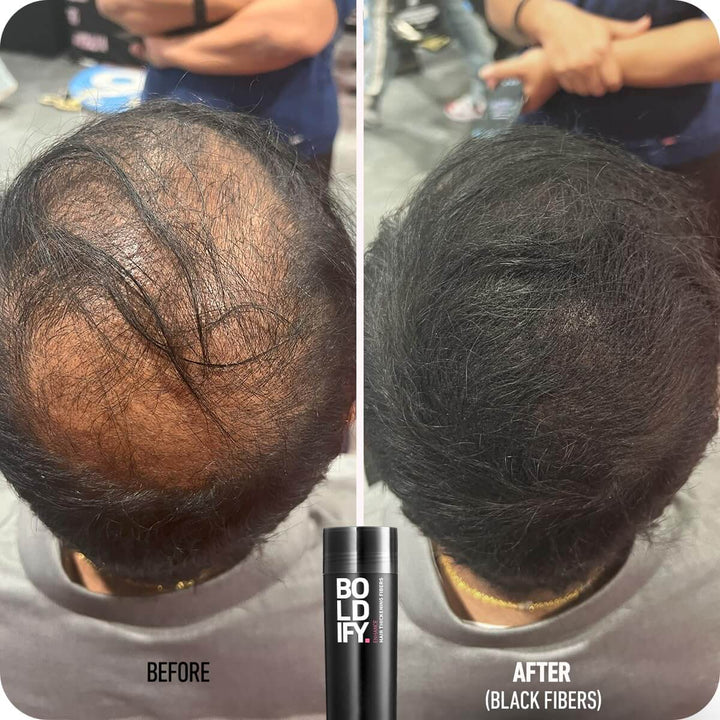 Boldify Hair Thickening Fibers 12g - Before and After